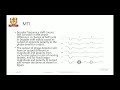 ej5i mar22535 ch 5part 2 mti radar radar display a scope ppi comparison of cw u0026pulse radar1 1