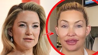 Top 10 Celebrities Who Permanently Ruined Their Face