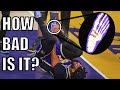 Foot Doctor Explains Anthony Davis' Season Threatening Injury (Midfoot Sprain)