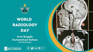 World Radiology Day | Prof Brig (R) Muhammad Nafees | PAF Hospital