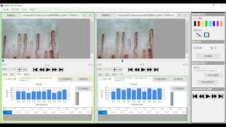 [GOKO]流速計測ソフトGOKO-VIP (毛細血管スコープGOKO Bscan-Z/ZD 専用オプション）