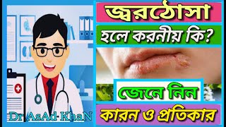 জ্বরঠোসা কেন হয়, লক্ষন ও তার প্রতিকার। বাংলা স্বাস্থ্য টিপস_By 👨‍⚕️Dr AsAd KhaN👨‍⚕️