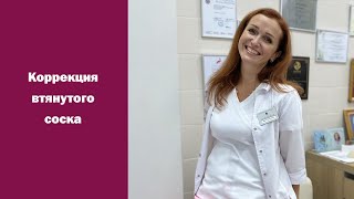 Коррекция втянутого соска. Что нужно знать об операции?