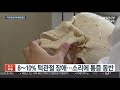 10명중 1명 턱관절 장애…치료 미루면 만성화 위험 연합뉴스tv yonhapnewstv