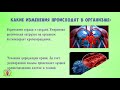 ЧТО БУДЕТ ЕСЛИ МНОГО ХОДИТЬ КАЖДЫЙ ДЕНЬ. Чем полезна ходьба Ходьба для похудения.