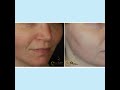 zo skin health skin care with wow results