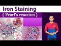 Iron Staining Clear Explain ( Pearl's stain / Prussian blue reaction )