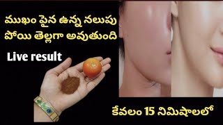 ముఖం పైన ఉన్న నలుపు పోయి తెల్లగా అవుతుంది/instant face glow/howtoremovepigmentationathome