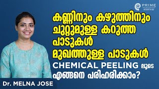 Malayalam Chemical Peeling | കഴുത്തിനു ചുറ്റുമുള്ള പാടുകൾ, മുഖത്തുള്ള പാടുകൾ  എങ്ങനെ പരിഹരിക്കാം?