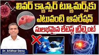 What is the latest treatment for liver cancer | How to do TACE Cancerous Tumor Therapy | Dr Devu