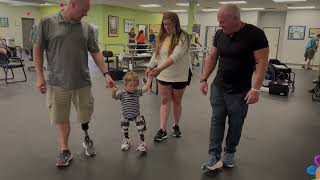 Louie, Bilateral Above Knee PPS Socket Congenital Amputee