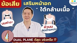 ปี2023 เสริมหน้าอกใต้กล้ามเนื้อ Dual Plane ไม่ได้ดีที่สุด เพราะอะไร