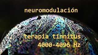 ayuda tinnitus audio terapia neuromodulación 4000 Hz