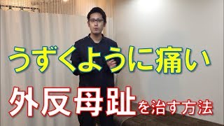 うずくように痛い外反母趾の治し方とストレッチ｜京都市北区　もり鍼灸整骨院