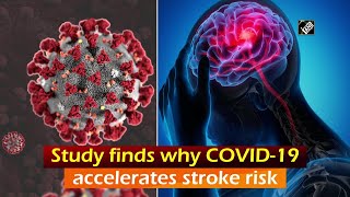 Study finds why COVID-19 accelerates stroke risk