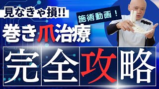 【患者さん　巻き爪治療　ビフォーアフター】巻き爪患者さんのビフォーアフター　どんな治療をしてどうなったかが一目瞭然　巻き爪の治療をしたい方は必見です。＃巻き爪　＃巻き爪治療＃巻き爪ケア