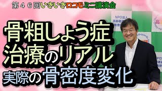 骨粗しょう症治療のリアル　実際の骨密度変化