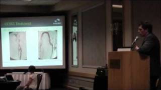 Synergy CCSVI Seminar - Dr. Hewett part 1