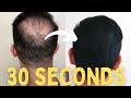 How To Apply Toppik To Your Crown *Less Than A Minute