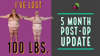 Weight Loss Surgery in Mexico 5 Month Post-Op Update  | My Gastric Bypass Journey