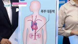 경동맥, 뇌로 가는 혈액 80%를 공급 [굿모닝 정보세상] 74회 20190924