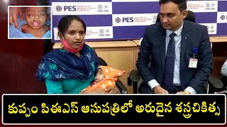 కుప్పం PES ఆసుపత్రిలో అరుదైన శాస్త్రి చికిత్స | News On Tv