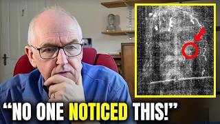 Doctor Reveals SHOCKING Truth About Shroud of Turin