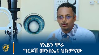 የአይን ሞራ ግርዶሽ መንስኤና ህክምናው