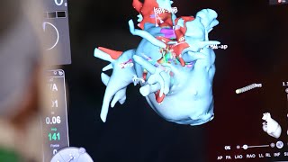 Mayo Clinic Minute: What is cardiogenic shock?