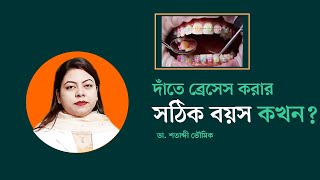 দাঁতে ব্রেসেস করার সঠিক বয়স | জেনে নিন বিস্তারিত