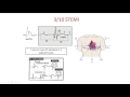 ecg ischemia