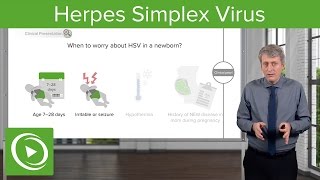Febrile Baby: Herpes Simplex Virus – Pediatrics | Lecturio