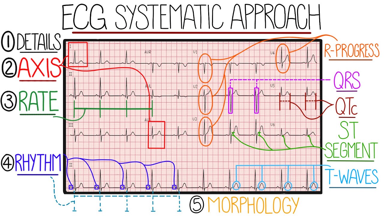 Ecg Interpretation Made Easy Learn How To Interpret An Ecg In 13