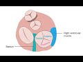 Imaging the tricuspid valve in echocardiography