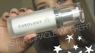 CUROLOGY REVIEW! Does it work? Worth the money? My experience! + skincare advice