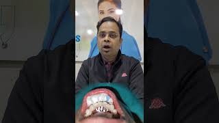 FIX Loose Teeth in ONE Dentist Visit? #dentalclinic #dentalimplants #dentistry #teethwhitening