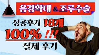 음경확대, 조루수술 18개의 후기 모음 실제 리얼 수술후기