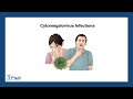 Cytomegalovirus Infections