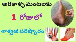 అరికాళ్ళ మంటలకు 1 రోజులో శాశ్వత పరిష్కారం|Natural remedie for burning feets#Arikalla mantalu