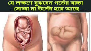 গর্ভের শিশু সোজা না উল্টো হয়ে আছে কিভাবে বুঝবেন? গর্ভে বাচ্চা উল্টে থাকে কেন- Reverse Baby Position