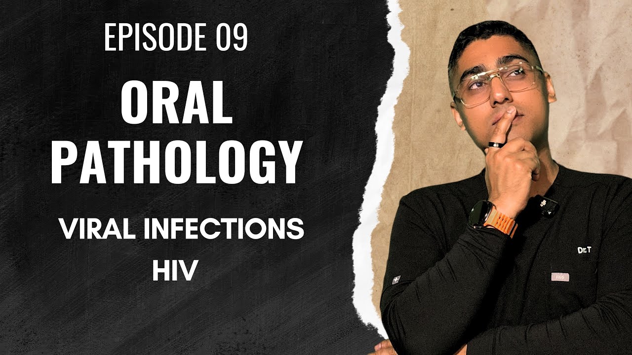 Dental Digest Oral Pathology Episode 9 Hiv Youtube
