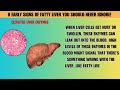 8 early signs of fatty liver you should never ignore