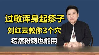 孩子过敏起疹子，中医3个穴调理，家长感叹：中医也能这么快？