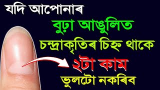 বুঢ়া আঙুলিত চন্দ্ৰাকৃতিৰ চিহ্ন থাকিলে ২টা কাম ভুলটো নকৰিব | দুখ সমস্যাই লগ নেৰা হয় | ASSAMESE VIDEO