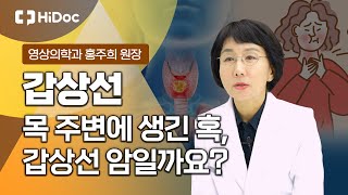 목 주변에 생긴 혹, 갑상선 암 가능성 있을까?...영상의학과 홍주희 원장