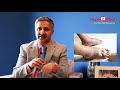 causes and treatment of leg swelling or edema pakistan’s top nephrologist professor shafiq cheema