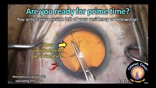 CataractCoach™1821: Are you ready for prime time?