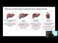 fatty liver disease are you at risk university of florida health wellness university seminar