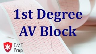 1st Degree AV Block ECG - EMTprep.com