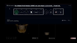 R2GATE Digital oral design (DOD) video manual